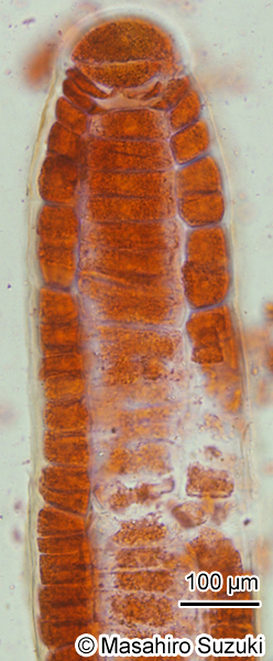 フクリンアミジ Rugulopteryx okamurae